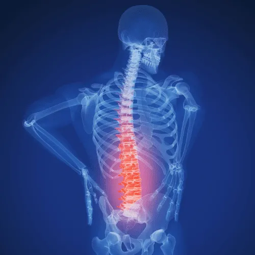 skeletal low back pain